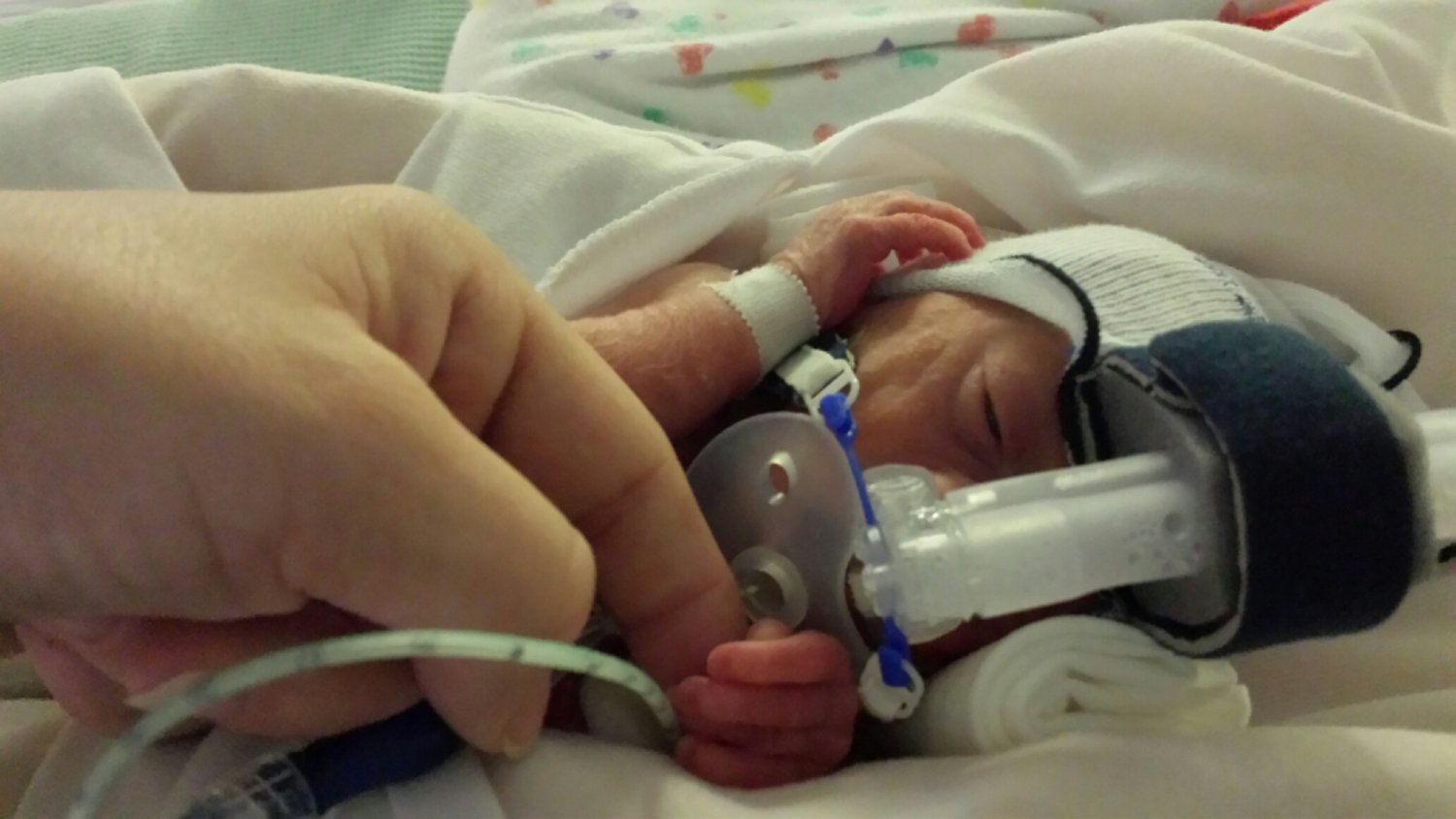 Premature baby using breathing machine