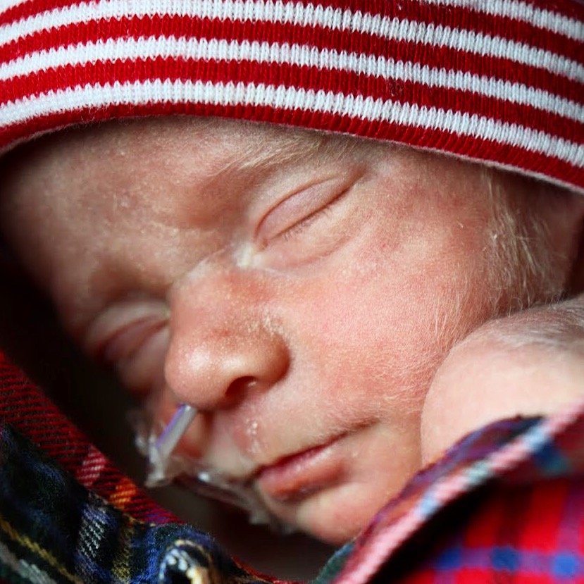 Premature baby with feeding tube, wearing hat