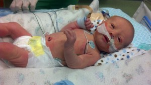 Travis on his first day in the NICU