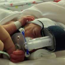 Premature baby on breathing machine