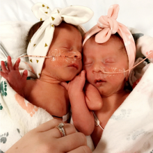 Twin infant girls with feeding tubes