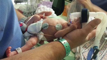 Liam in the NICU