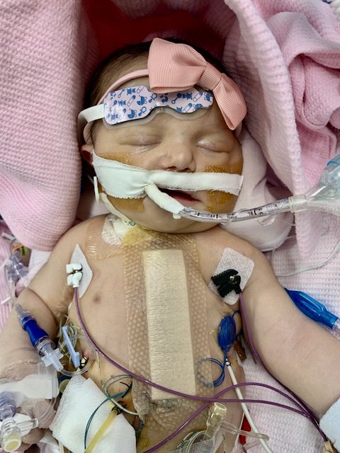 Sydni, after open heart surgery