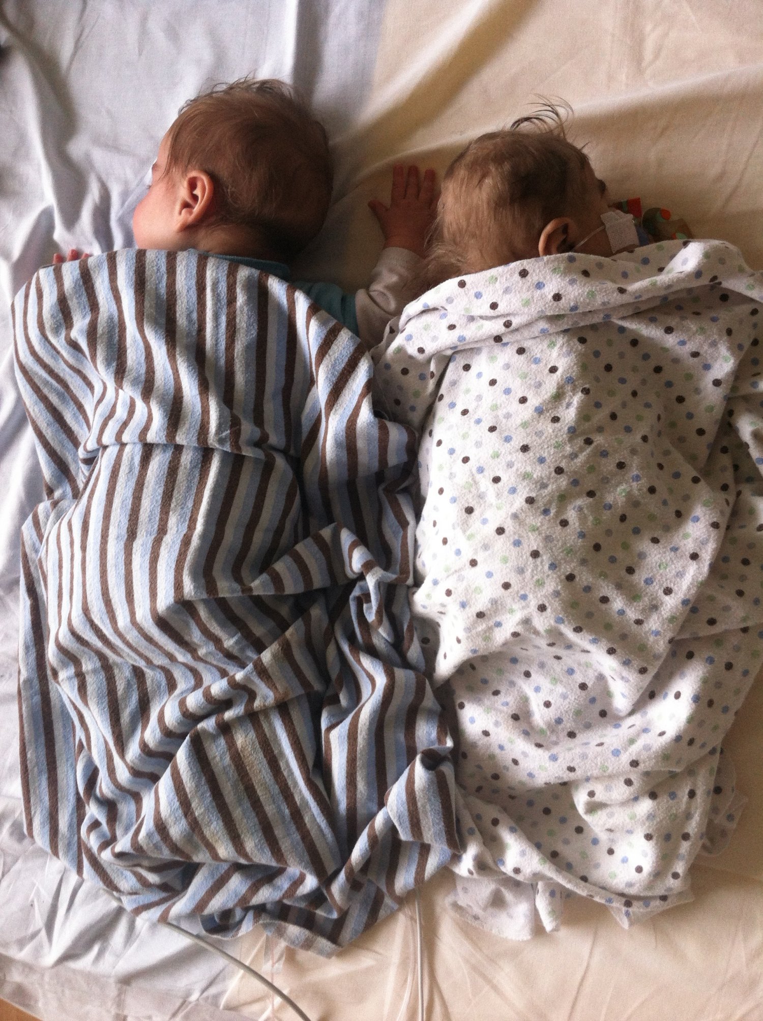 Twin infants, one much smaller than the other