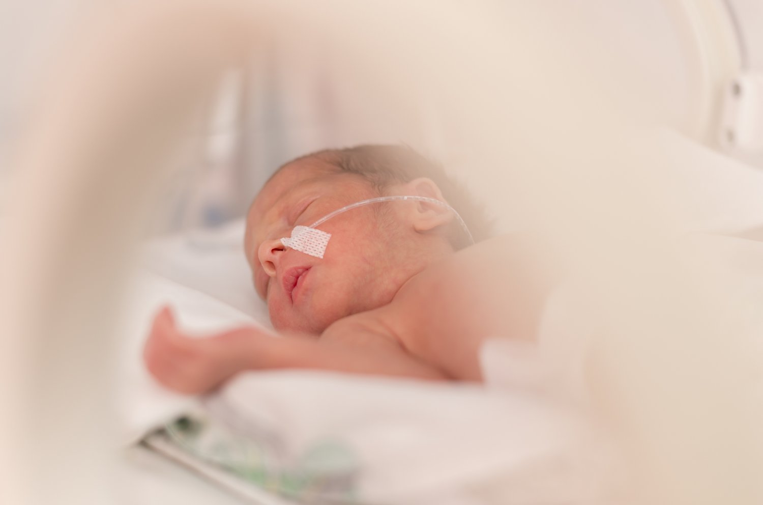 Premature baby with feeding tube